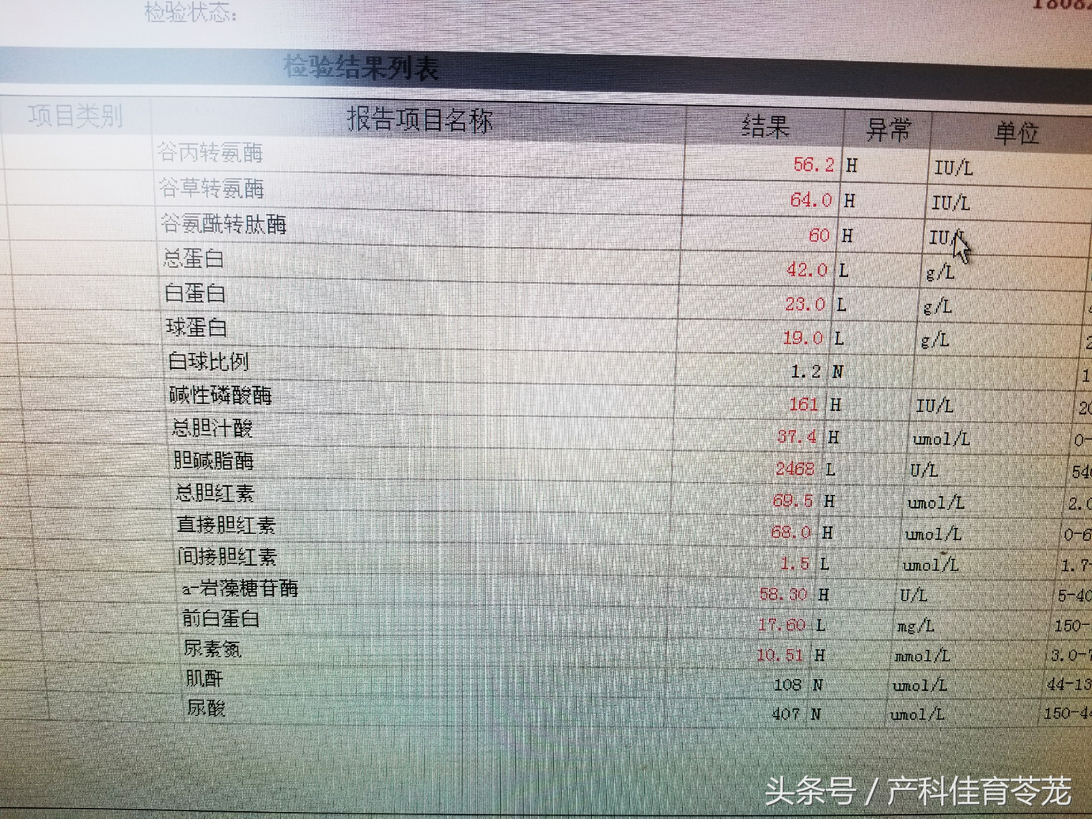 妊娠期肝功能异常是怎么回事,孕期胆汁淤积看肝功哪个指标