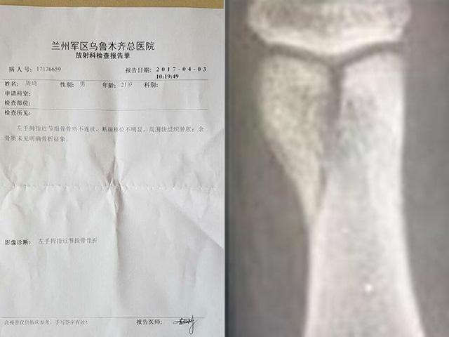 双面周琦:4年大起大落他经历了啥?逗比背后也是文青一枚