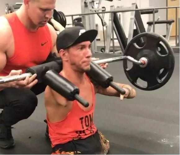 海豹畸形婴儿长大,海豹畸形宝宝