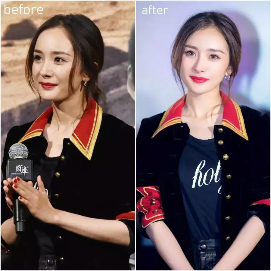 除了发量,最暴露年龄的可能是这两道纹