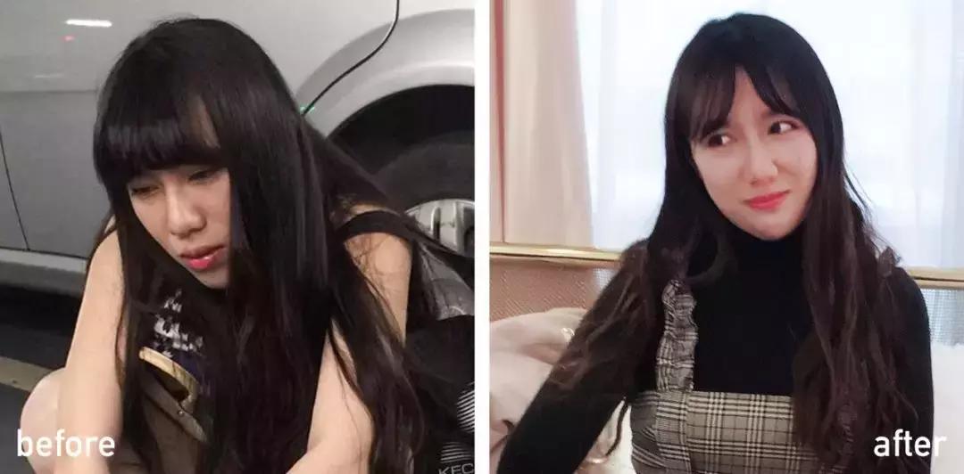 60岁整容亲身经历,整容亲身经历真的好吗