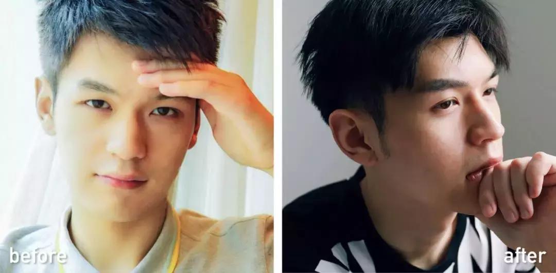 60岁整容亲身经历,整容亲身经历真的好吗