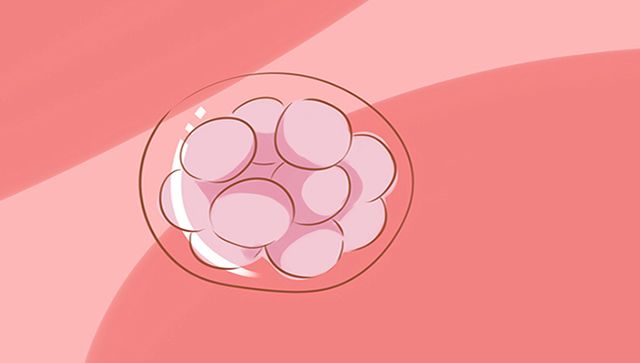 什么是葡萄胎？孕妈怎样才能提前发现？