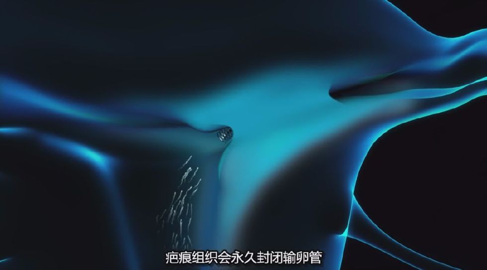 “*交性**意味着死亡”医疗行业背后的真相让人毛骨悚然