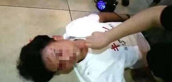 17岁男孩熬夜突发癫痫,17岁男子熬夜玩手机癫痫