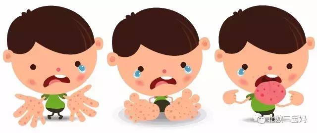 儿童急疹科普,宝宝湿疹和热疹的正确护理方法