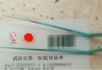 儿童鼻腔发臭,儿童鼻腔有臭味没鼻涕