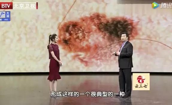 这四种痣会癌变赶紧来了解一下,这5种癌及早发现同样能治愈