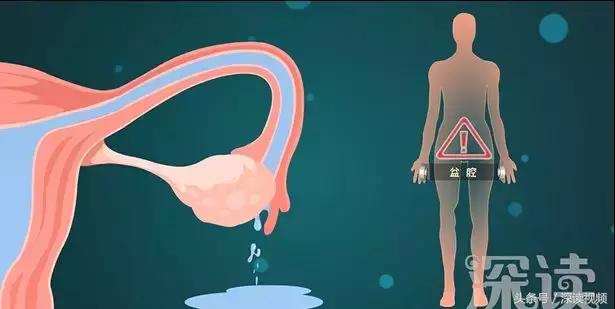 痛经，不孕竟是自己作出来的病，最萌“大姨妈”首秀，笑出猪叫声