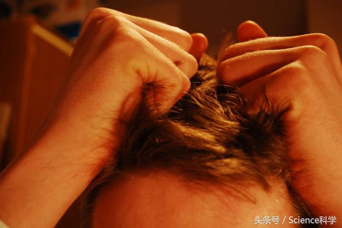 一紧张总是想抠头发怎么办,偶尔拔头发是拔毛癖吗