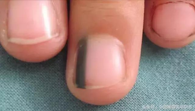 中国美容医学,中国美容医学杂志2017年