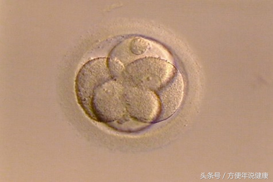 始终不能怀孕？千军万马只有1个受精，这4个原因不要耽误了你