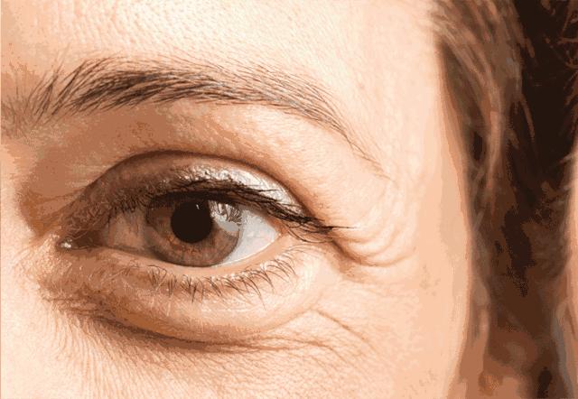 能去脂肪粒的眼霜,又能去纹又能去黑眼圈的眼霜