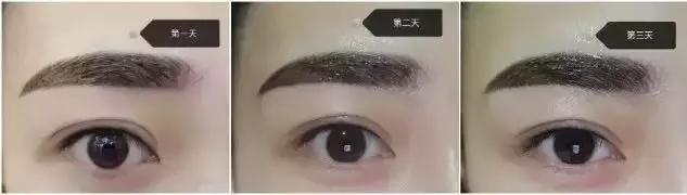 大浓眉如何彻底去除眉毛不再生长,半永久眉毛做完后还需要修眉吗