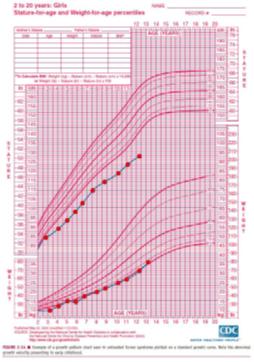 怎么规避turner综合征,turner综合征吃什么