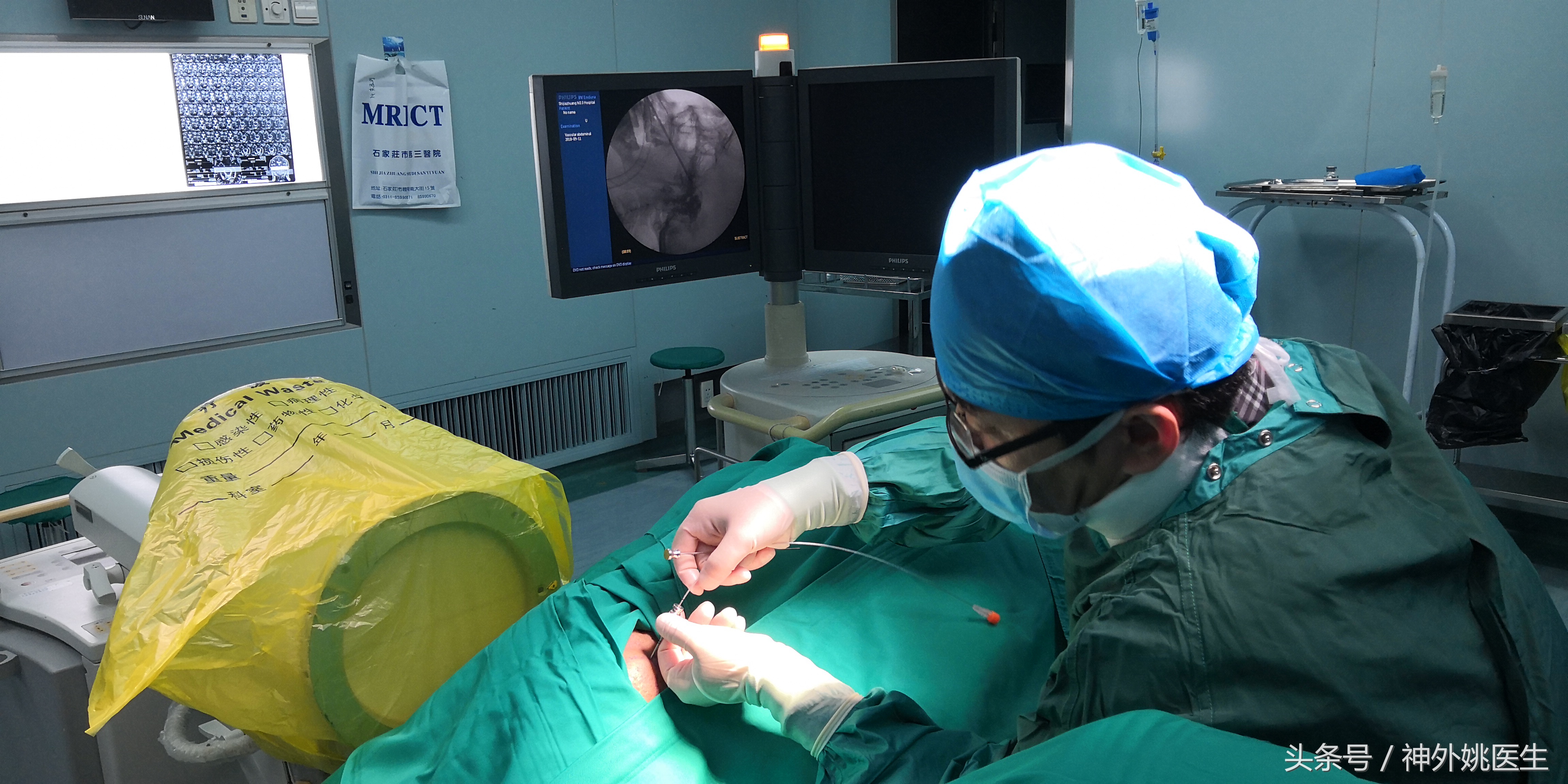 经皮三叉神经球囊压迫术穿刺路径,经皮穿刺三叉神经球囊压迫术