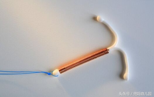 取环以后多久适合备孕,取环后多久备孕最好