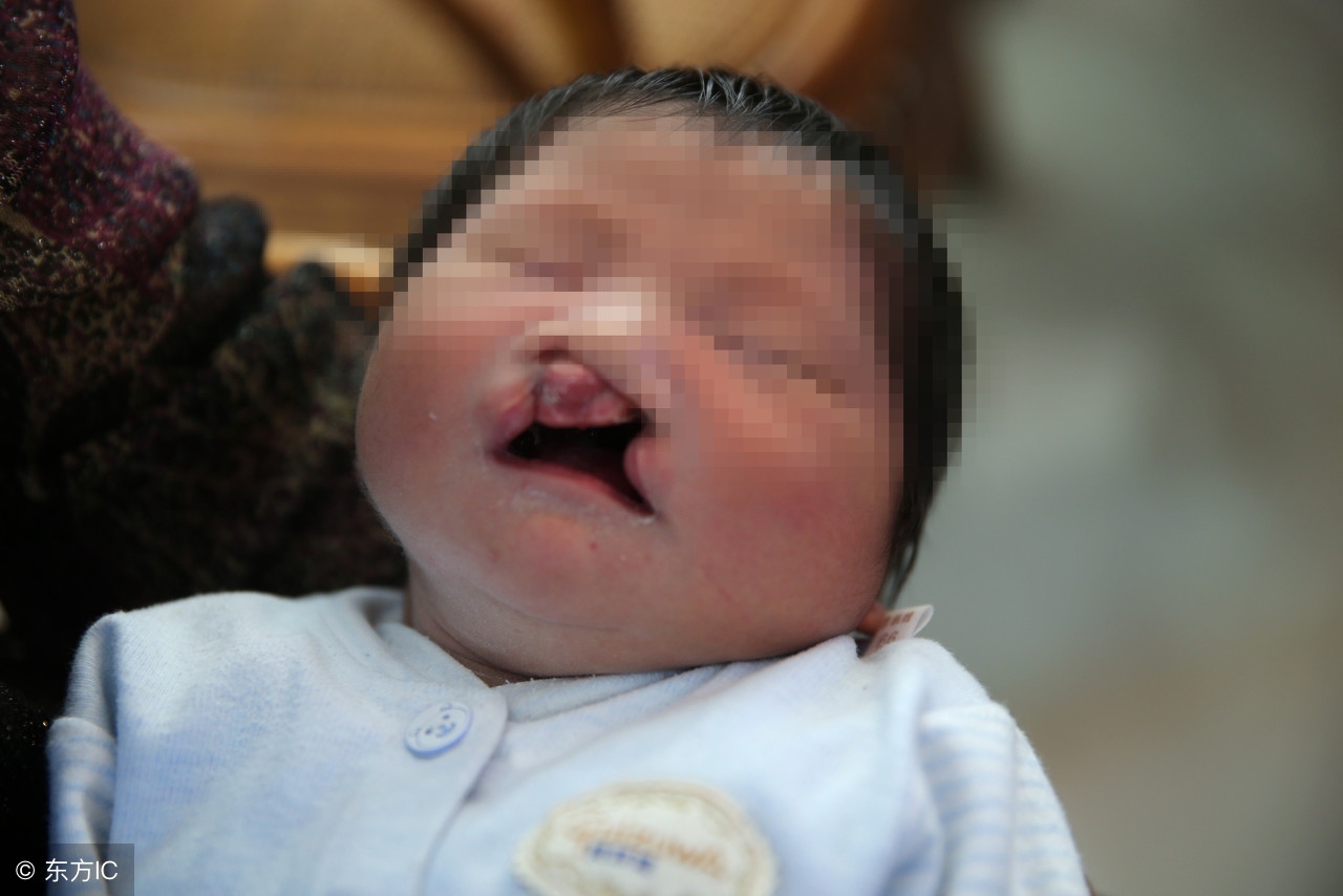 不是遗传得的病会遗传给下一代吗,精神类疾病真的会遗传给下一代吗