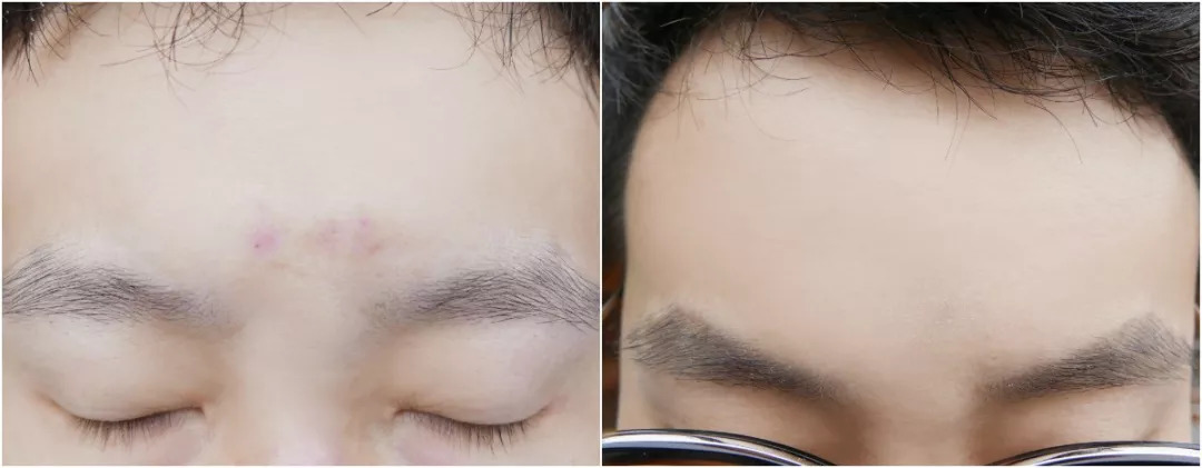 法国“奇愈”|只需一晚就能治愈痘印的地方,你想去吗?