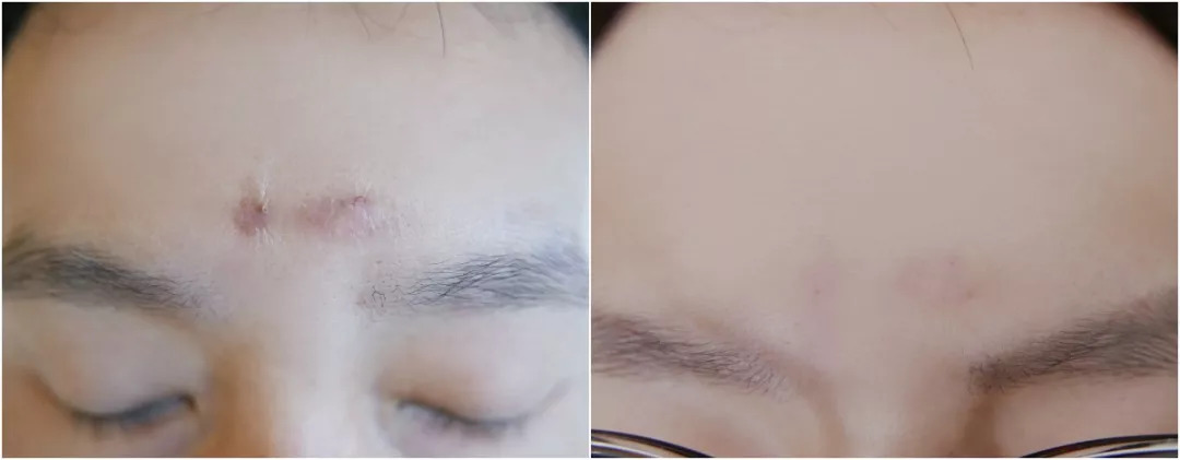 法国“奇愈”|只需一晚就能治愈痘印的地方,你想去吗?