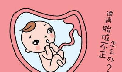 经产妇臀位顺产胎儿有什么风险,胎儿臀位什么睡姿能纠正臀位