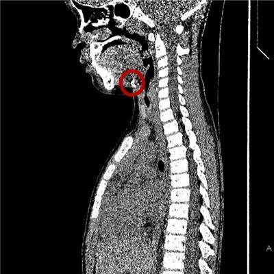 一些让人毛骨悚然拍到的照片,六个令人毛骨悚然的影像