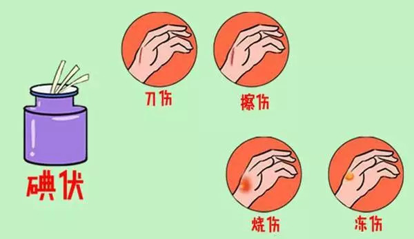 碘伏酒精紫药水哪个有利于伤口,紫药水红药水碘伏酒精哪种消毒好