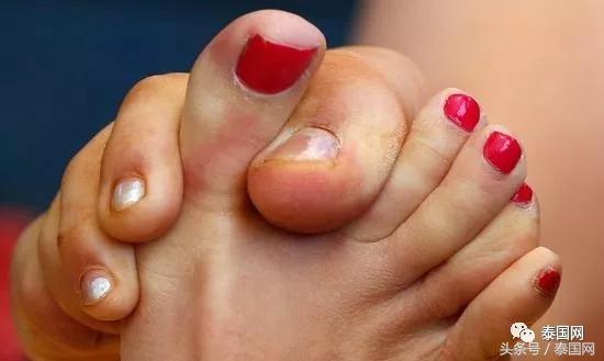 火遍全泰的这种“小鱼啃脚Spa”,你可知有多大健康风险?