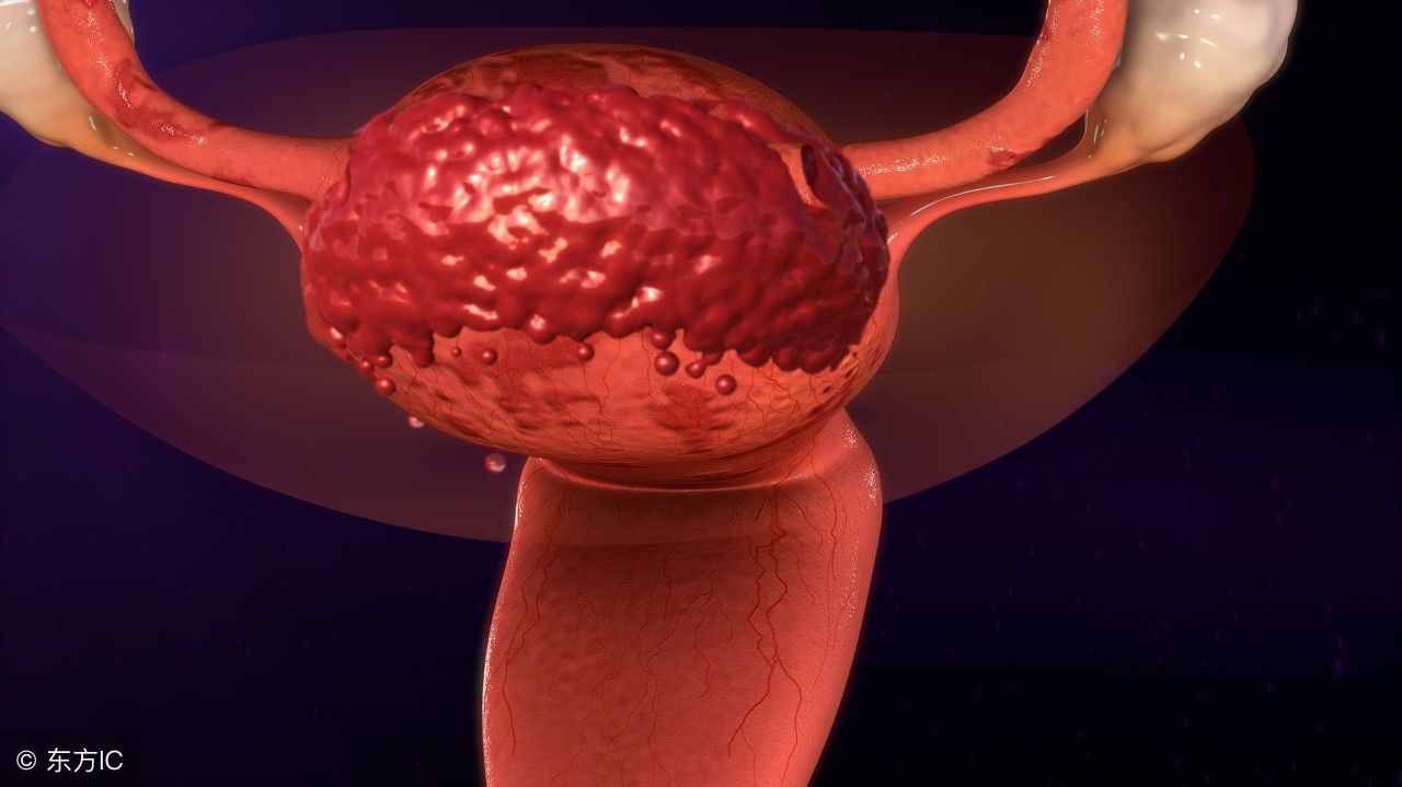 更年期是妇科三大恶性肿瘤的高发年龄,应该提高警惕