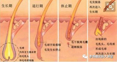毛发移植术亲身经历,杏林毛发移植手术