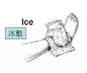 运动受伤后该怎么处理,运动受伤后如何处置