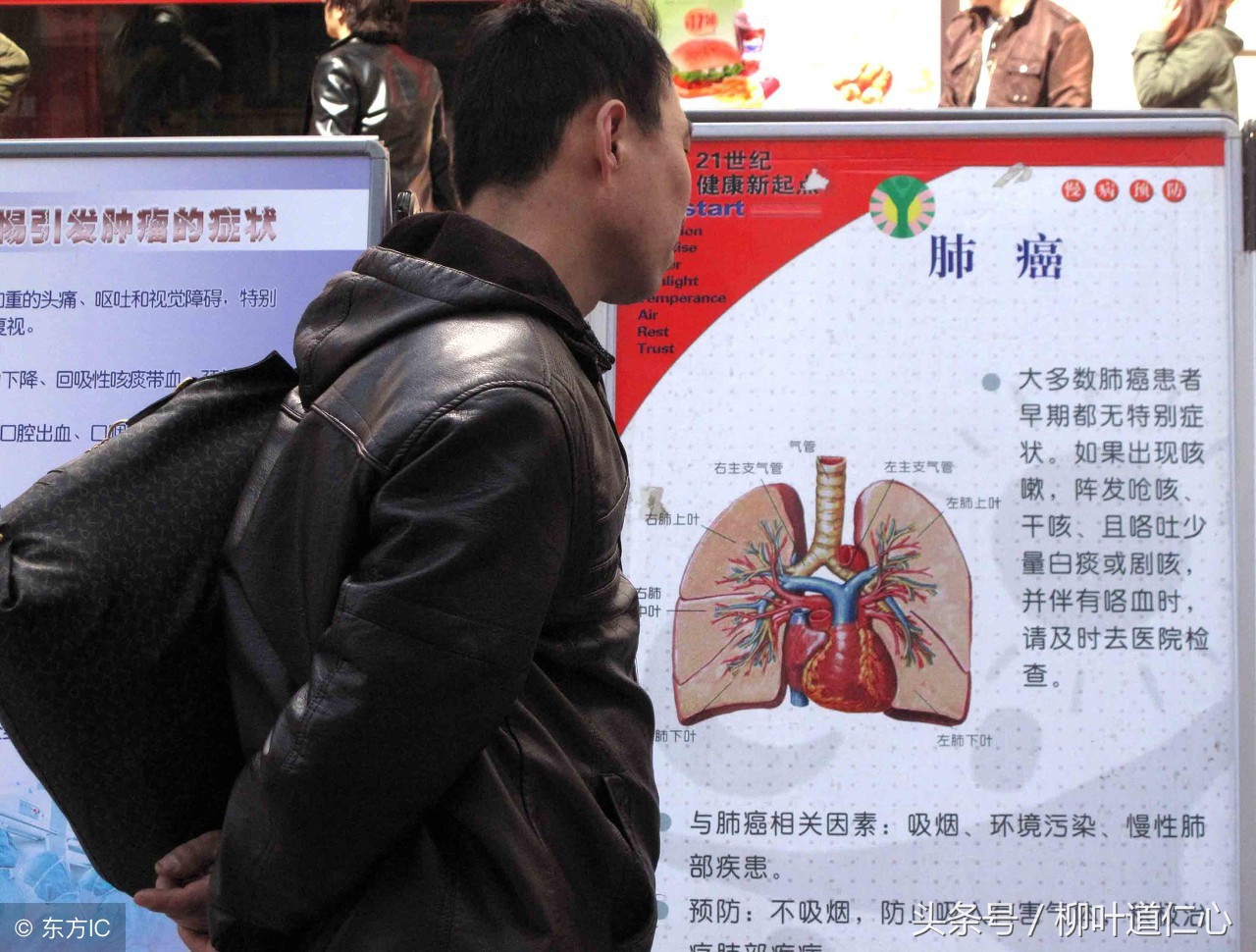 最全的肺癌科普知识,最靠谱的肺癌科普