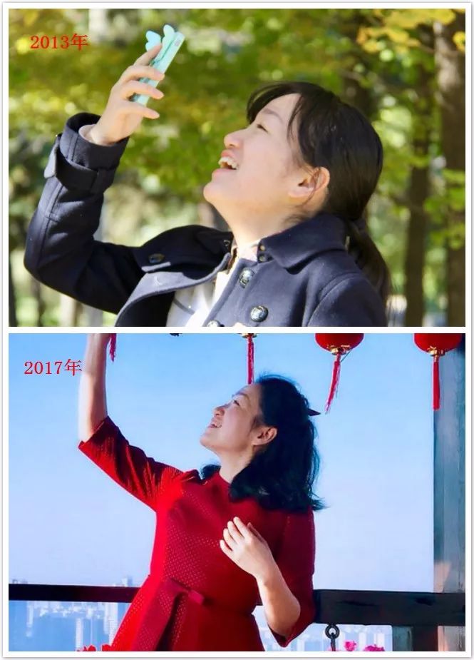 童颜机tripollar宙斯,童颜机tripollar溶脂