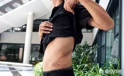 现在卖肾换苹果手机的如今怎样了,卖肾换二手苹果手机的如今怎样了