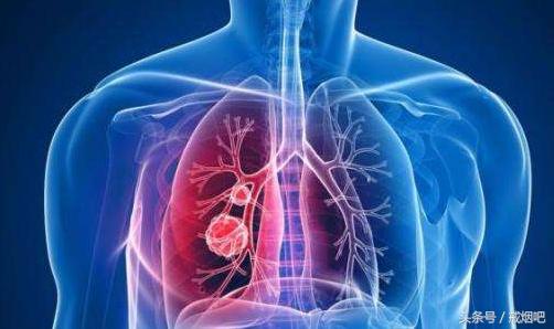 老烟民戒烟肺还是有焦油味,老烟民戒烟多久吐黑痰