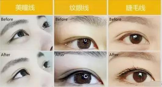 美瞳线睁眼闭眼都有神,美瞳线是睁眼有神闭眼无痕的