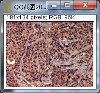 ihc免疫组化实验步骤及所需材料,免疫组化IHC实验步骤