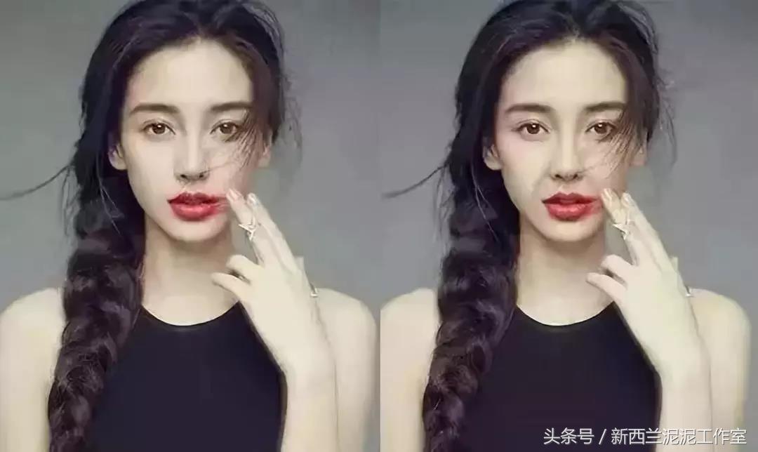 杨紫法令纹消除方法,女明星怎么解决法令纹的问题