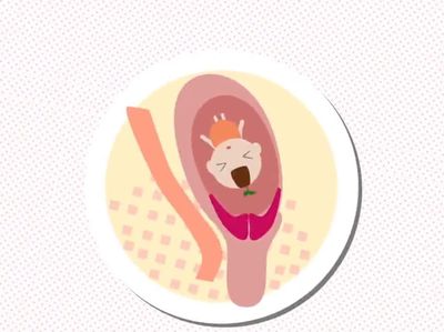 胎儿难产如何接生,难产的四个征兆