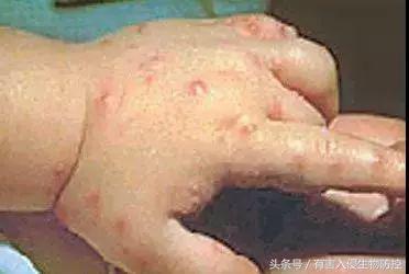 生物入侵红火蚁视频,红火蚁为什么是入侵物