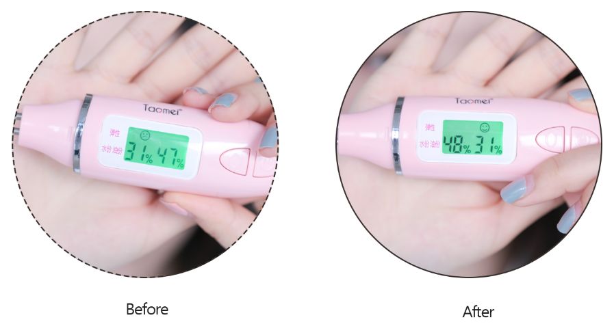 菲洛嘉十全大补面膜用了之后爆痘,十全大补面膜菲洛嘉值得购买吗