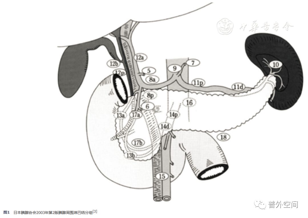 胰十二指肠切除范围有哪些,胰十二指肠切除术淋巴结清扫范围