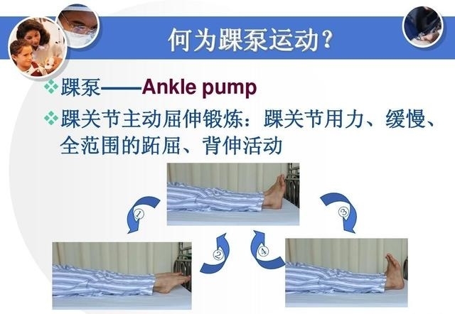 静脉有血栓能不能做骨科手术,骨科大手术深静脉血栓预防指南