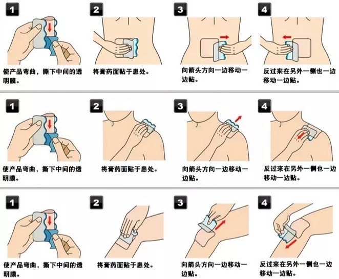 日本治疗创伤性关节炎,治疗关节炎的日本进口药