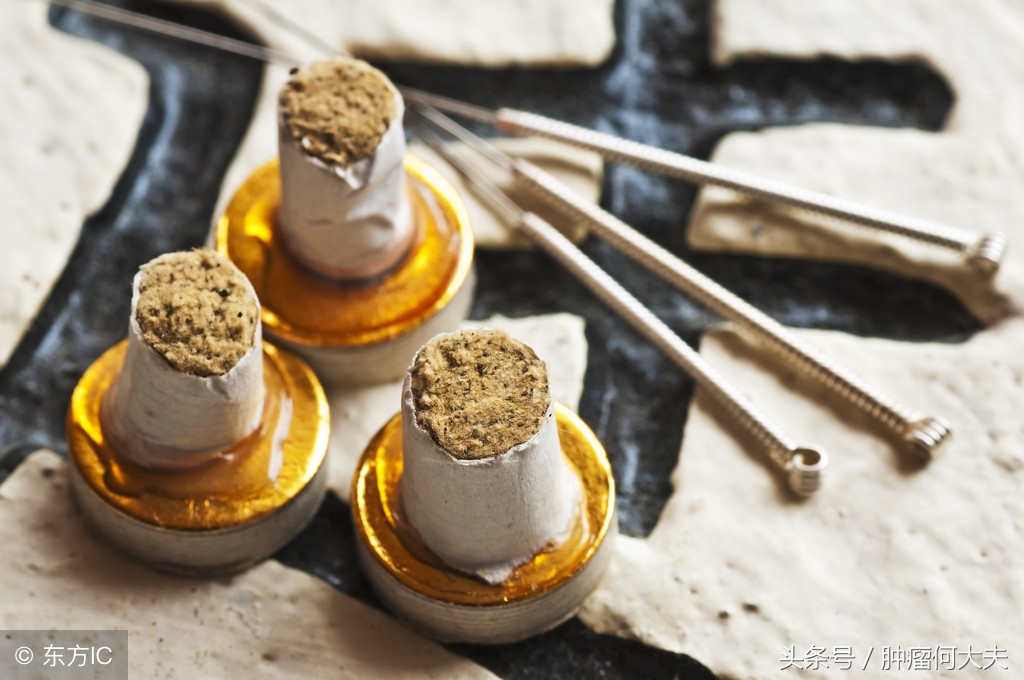 针灸治疗癌症最好的方法,针灸治疗癌症最好的穴位