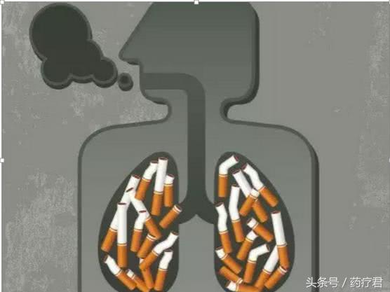 什么样的肺结节要警惕,什么是肺结节与肺癌的区别