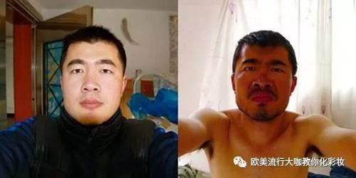 旅游脸晒伤怎么补救,孩子被太阳晒伤皮肤发红急救方法