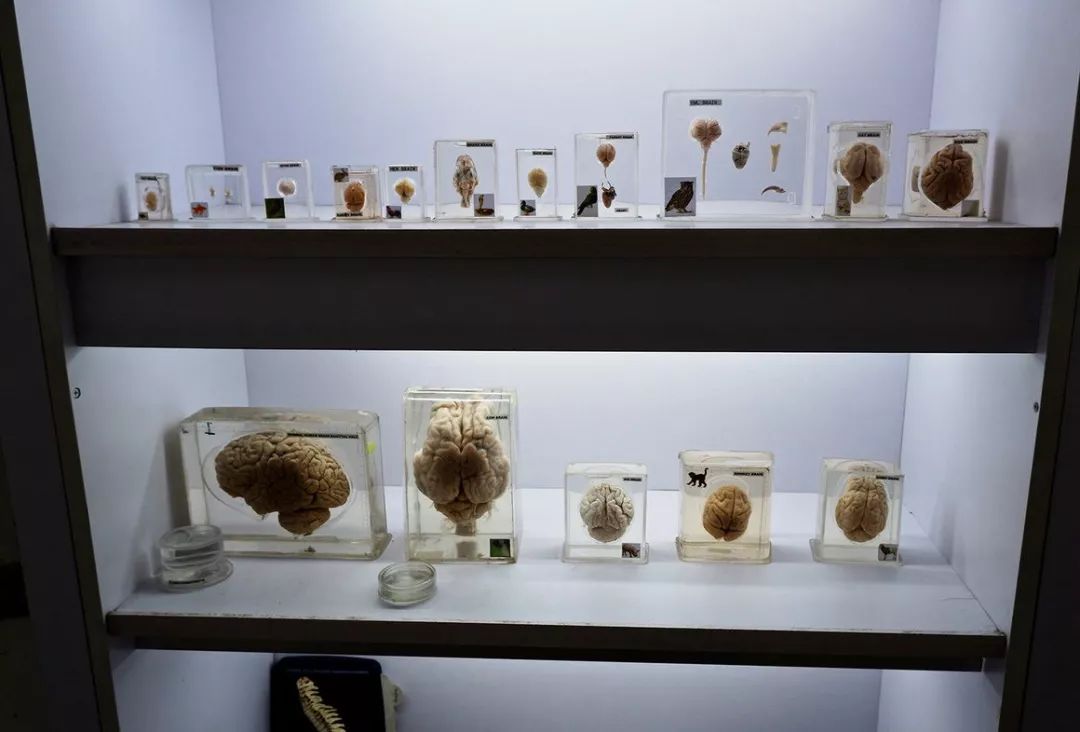 中国脑囊虫病,巨大脑囊虫病