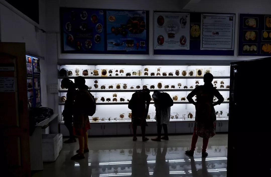 中国脑囊虫病,巨大脑囊虫病