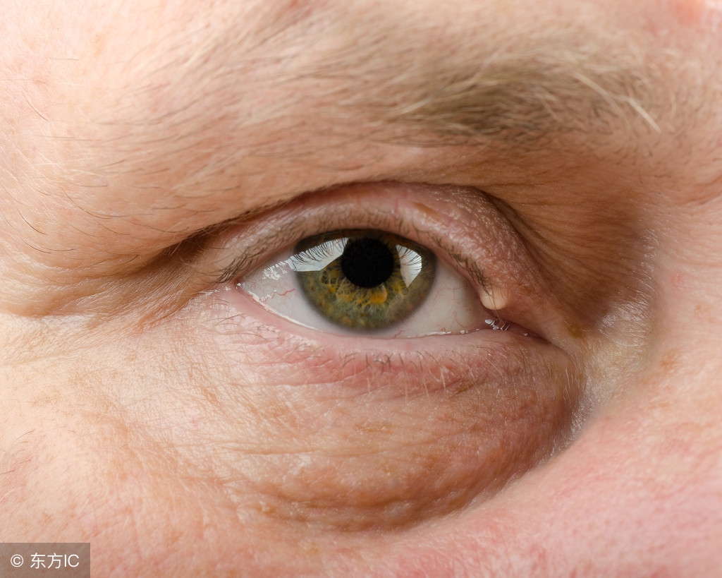 捉眼虫,捉眼虫是真的吗